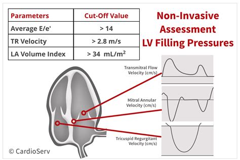 elevated left atrial filling pressure.